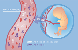 Xét nghiệm ADN trong sàng lọc dị tật bẩm sinh: Những điều cần biết