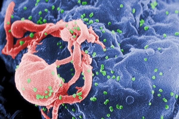 EGCG trong tr&agrave; xanh ngăn cản sự ph&aacute;t triển của HIV