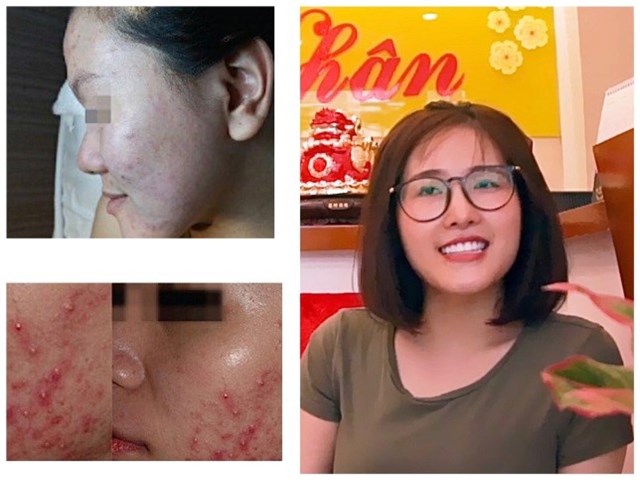 Ngọc Mai_ 24 tuổi, nh&acirc;n vi&ecirc;n văn ph&ograve;ng