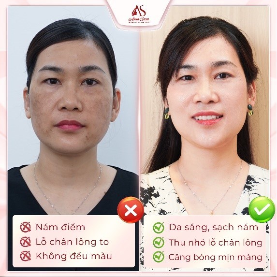 Làn da vào Xuân, năm mới thêm phơi phới - Ảnh 4