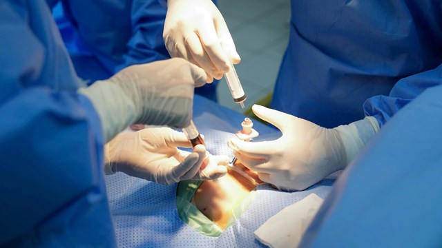 C&aacute;c b&aacute;c sĩ Bệnh viện Trung ương Huế thực hiện gh&eacute;p tế b&agrave;o gốc tạo m&aacute;u cho bệnh nhi