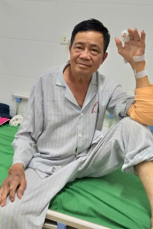 Bệnh nh&acirc;n Dương Văn Lạc l&agrave; CCB&nbsp; Qu&acirc;n t&igrave;nh nguyện rở về từ chiến trường L&agrave;o, bị bệnh hiểm ngh&egrave;o nổi cụ u tr&ecirc;n c&aacute;c khớp tứ chi
