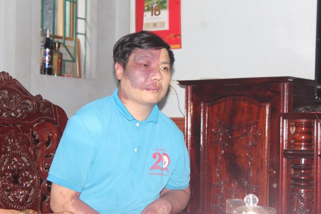 Con trai &ocirc;ng Phạm Ngọc Hậu &ndash; nạn nh&acirc;n chất độc da cam, mang di chứng từ cha.