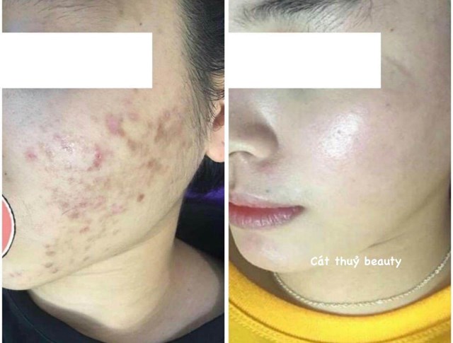 Từng bừng khai trương C&#225;t Thủy Beauty &amp; Academy tại 562 C&#249; Ch&#237;nh Lan - H&#242;a B&#236;nh - Ảnh 4