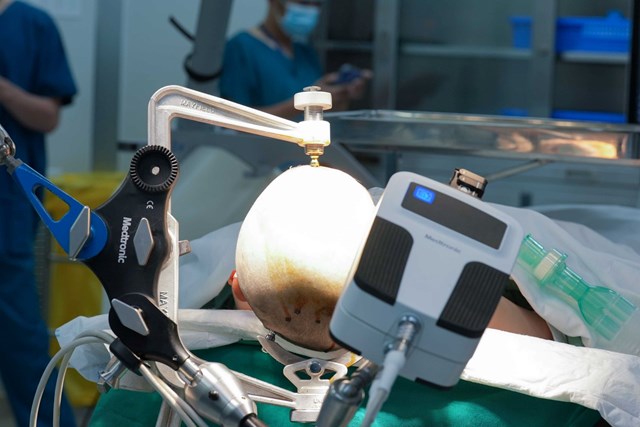 C&aacute;nh tay Robot AutoGuide gi&uacute;p b&aacute;c sĩ đặt điện cực v&agrave;o nội sọ được ch&iacute;nh x&aacute;c v&agrave; nhanh ch&oacute;ng &nbsp;