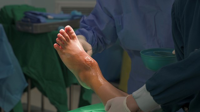 Khối u &acirc;m thầm ph&aacute; huỷ đến 80% thể t&iacute;ch xương s&ecirc;n của người bệnh, g&acirc;y ra những cơn đau đầy &aacute;m ảnh.